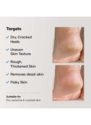 Cureskin Foot Care Cream for Cracked Heels | Repairs, Softens, and Exfoliates | Foot Cream for Women and Men, 50 g (Pack of 1) - view 5